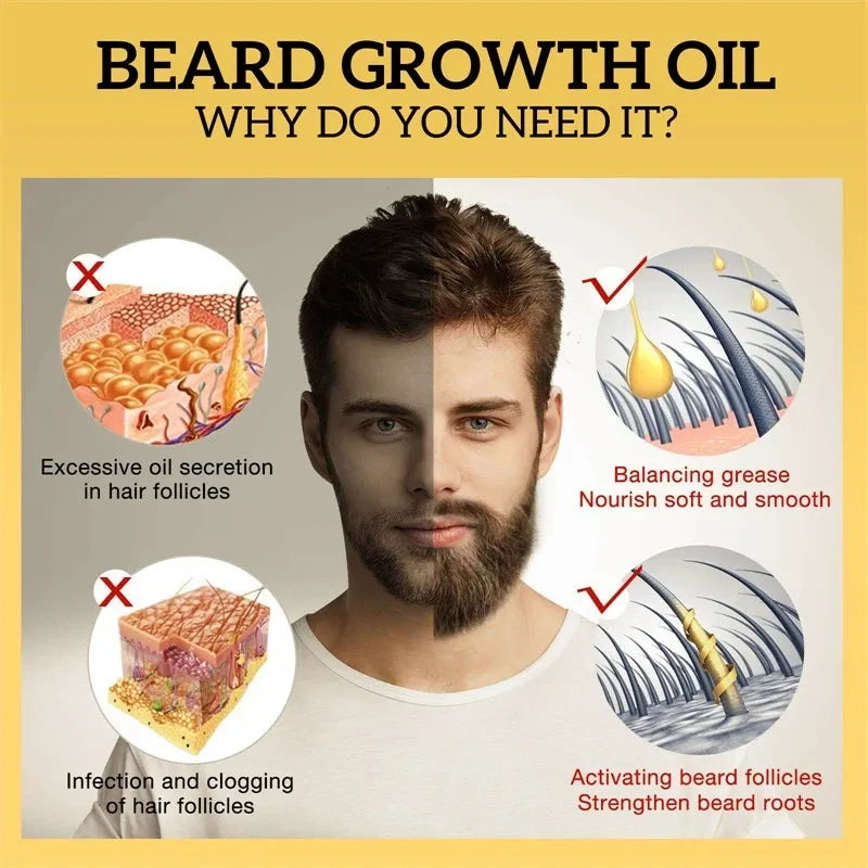 UPTOWN LA Beard Growth Oil for Men
